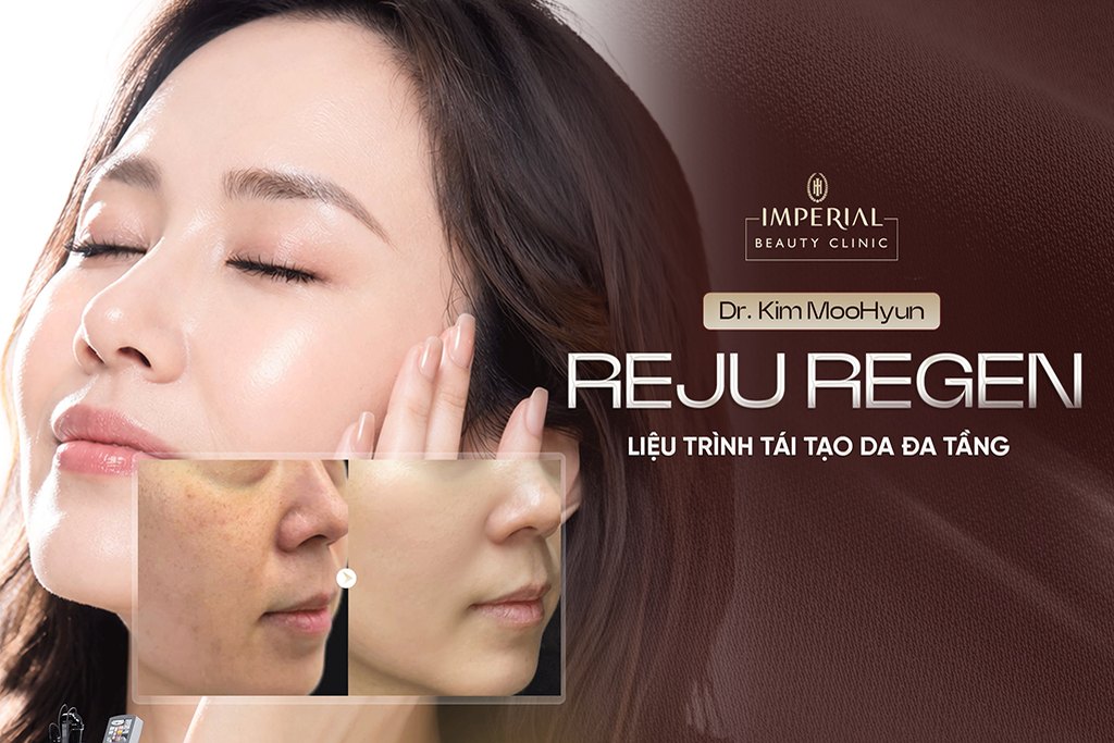 [IBC-LIVE-10] Reju Regen – Điều trị sắc tố & tái tạo da